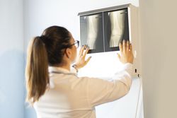 Young doctor with x-ray film document on wall