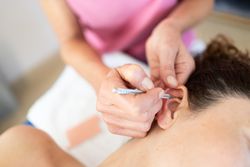 Therapist using ear pen for auriculotherapy treatment on female patient