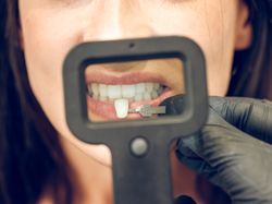 Crop dentist putting on tooth implant on jaw of woman