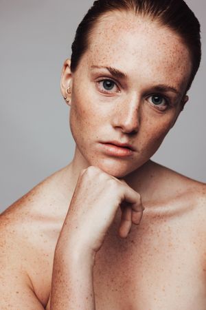 Young woman with lots of freckles