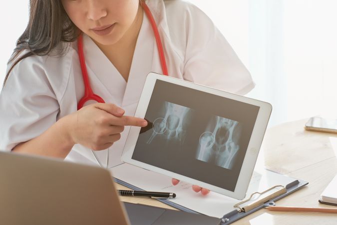 Unrecognizable medic showing x ray scan during online consultati