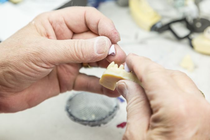 Dental Technician Working On 3D Printed Mold For Tooth Implants