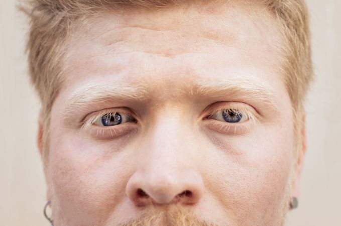 Close up portrait of the eyes of a Latino man with albinism