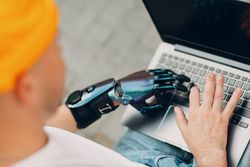Man with prosthetic hand typing on a computer