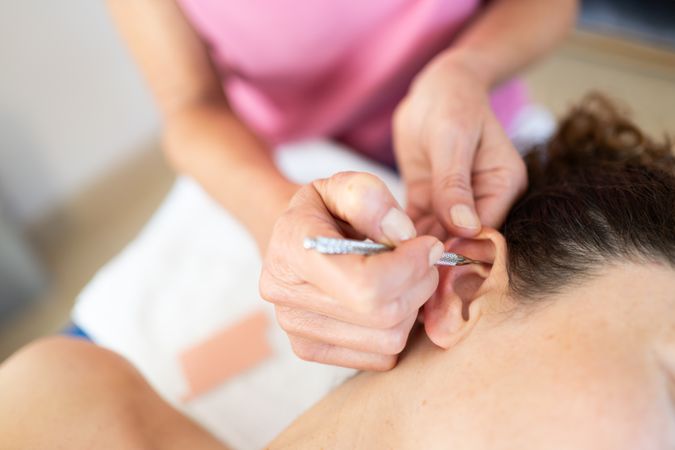Therapist using ear pen for auriculotherapy treatment on female patient