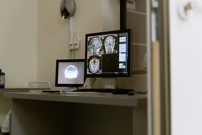 Computer screen showcasing MRI results