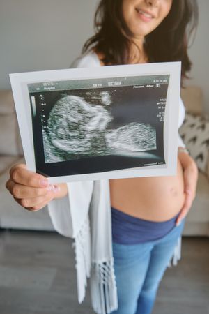 Crop woman showing ultrasound image of baby