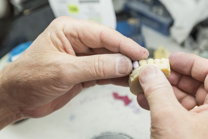 Dental Technician Working On 3D Printed Mold For Tooth Implants