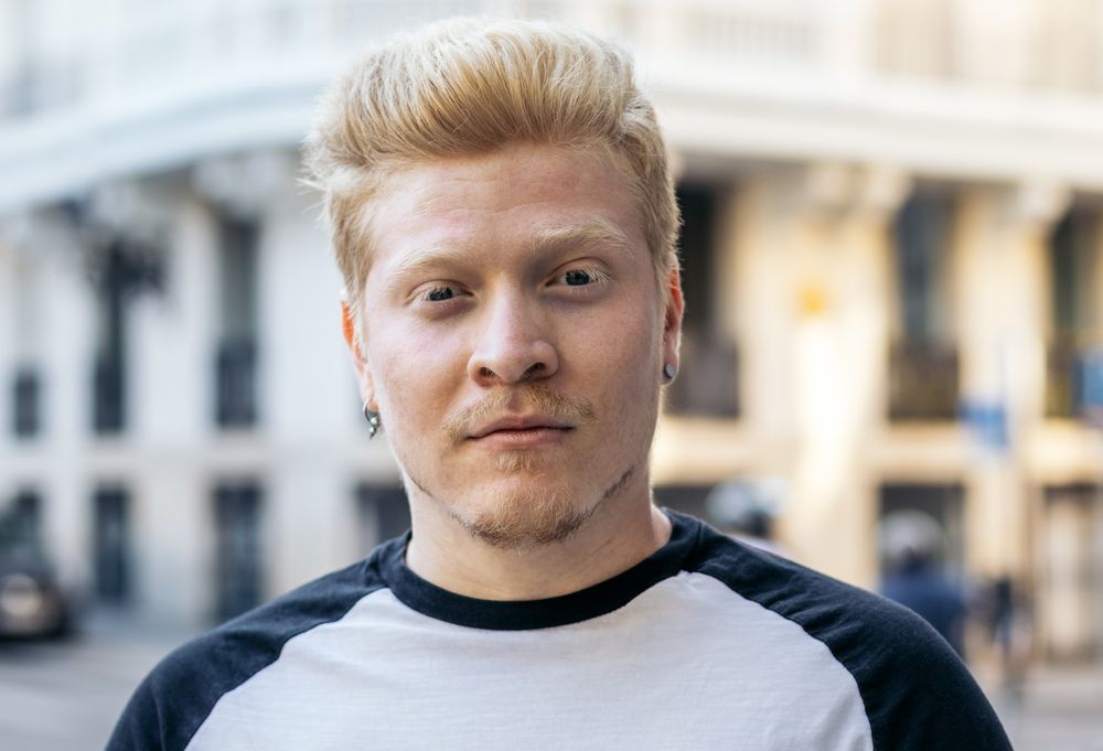 Close-up of Latino man with albinism in the city street.