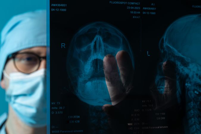 Doctor examining skull X-ray film