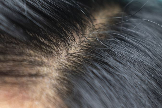 man's hair