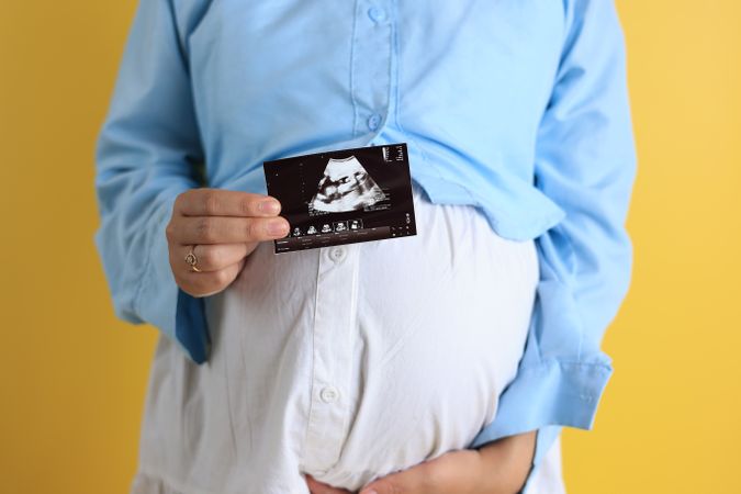 Pregnant Woman with Ultrasound Picture on Yellow Background