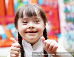 Portrait of happy girl with Down syndrome doing the thumbs up sign 0KKYZ0