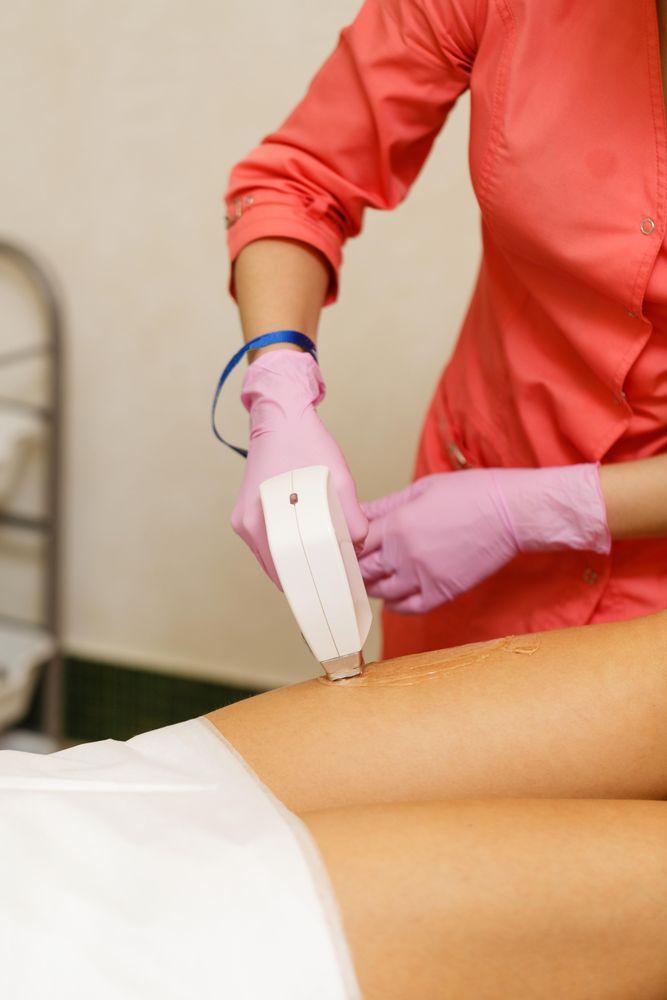 Close up of woman having hair removed on upper leg with laser treatment, vertical