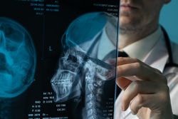Doctor analyzing skull X-ray with stylus
