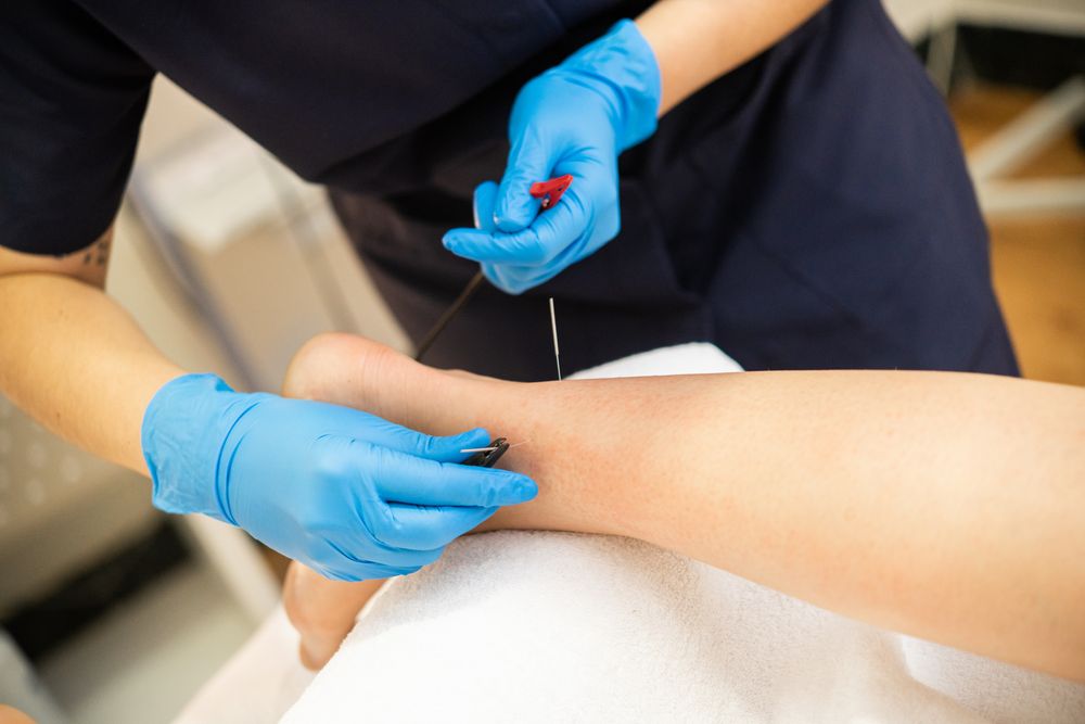 Medical professional in latex gloves doing electro acupuncture