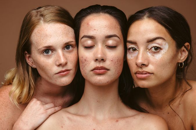 Beauty models with real skin conditions