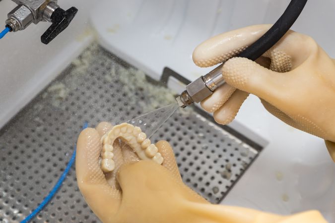 Dental Technician Cleans 3D Printed Dental Implant Bridge