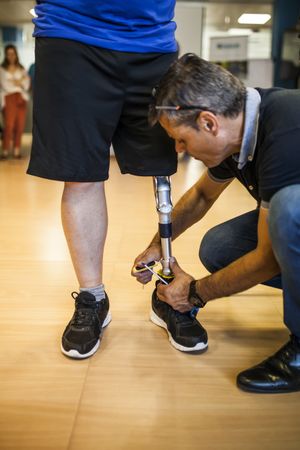 man helping amputated young man testing the new leg prosthesis