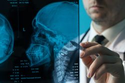 Doctor analyzing skull X-ray with stylus