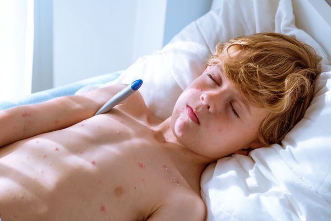 Calm boy with chickenpox measuring temperature on bed