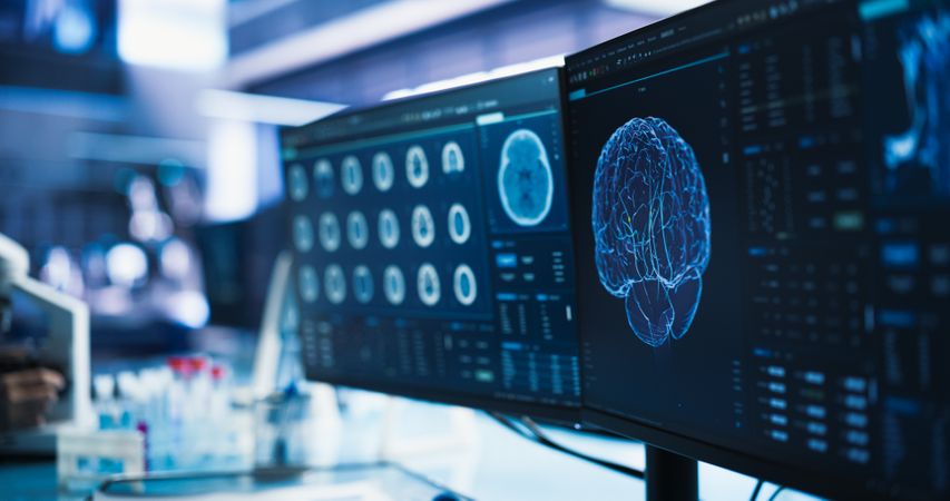 Cancer Research Center Medical Laboratory: Close Up of a Set of Desktop Computer Monitors Showing CT Scans Of Human Brain.