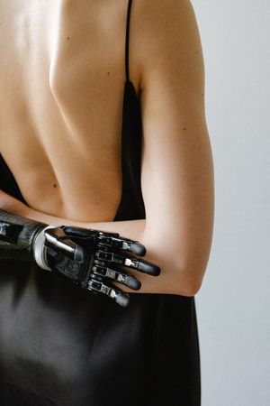 Back view of woman with prosthetic hand