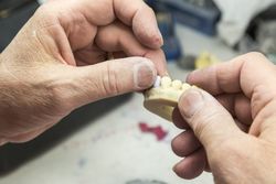Dental Technician Working On 3D Printed Mold For Tooth Implants
