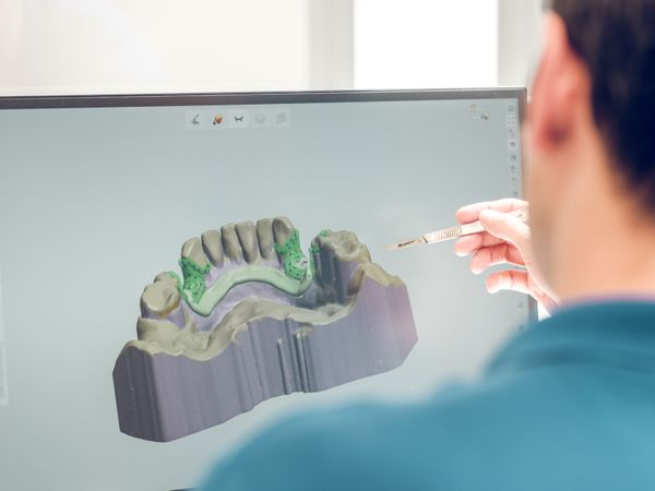 Anonymous dentist modeling jaw on computer