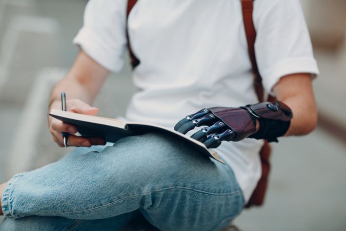 Young man with prosthetic hand holding a notebook
