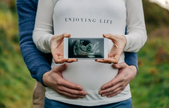 Pregnant couple showing ultrasound on the mobile with her partner