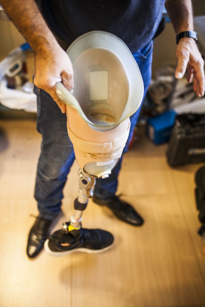 crop man fixing prosthesis in workshop