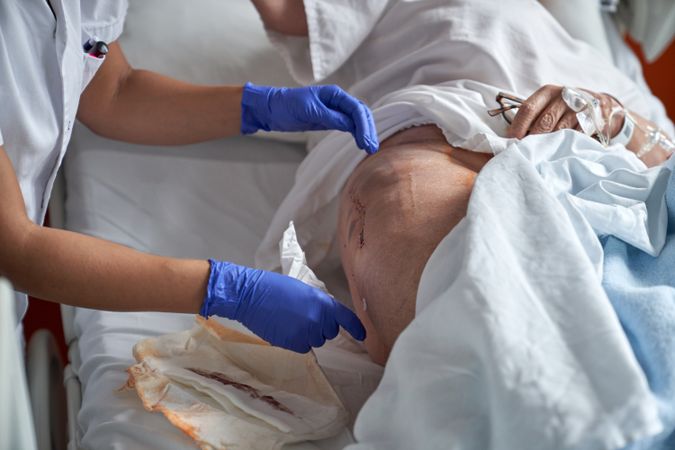 Unrecognizable nurse applying surgical plaster on leg of patient