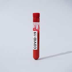Vial of blood labelled with “COVID-19”