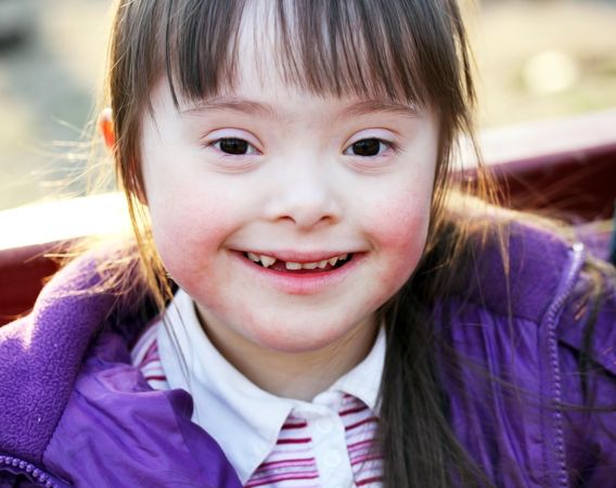 Smiling young girl with Down syndrome dressed in a purple coat