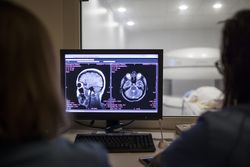 open magnetic resonance machine