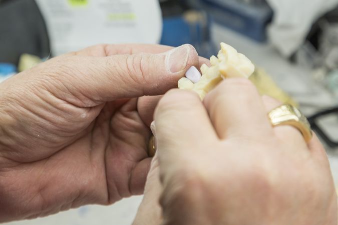 Dental Technician Working On 3D Printed Mold For Tooth Implants