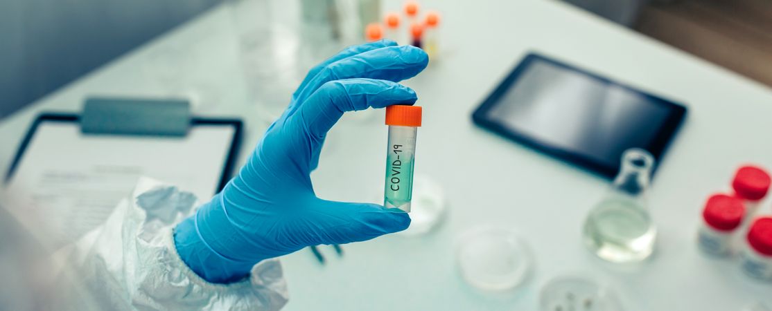 Scientist hand showing vial with vaccine