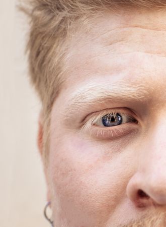 Close up portrait of a Latino man with albinism