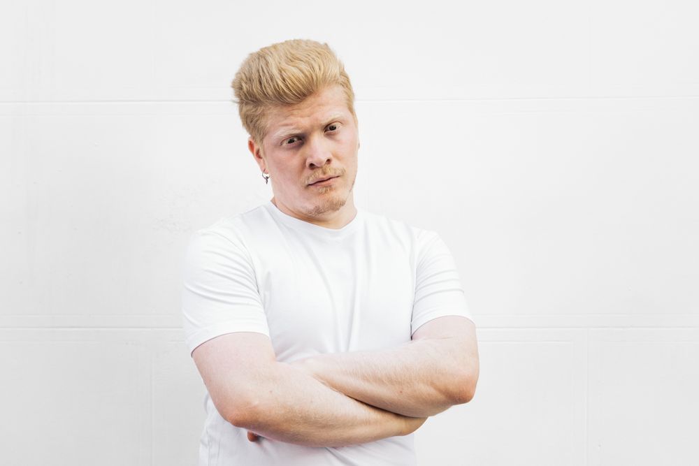 Monochrome: Portrait of a Latino man with albinism and t-shirt against a light background.