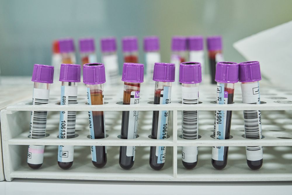 Set of test tubes with blood in donation center