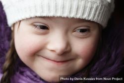 Closeup portrait of young girl with Down syndrome in a winter hat bYNyN0