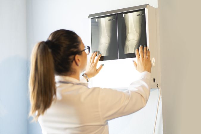 Young doctor with x-ray film document on wall