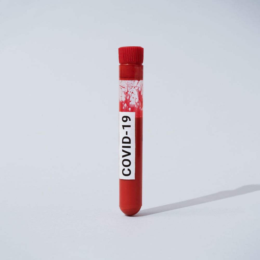 Vial of blood labelled with “COVID-19”
