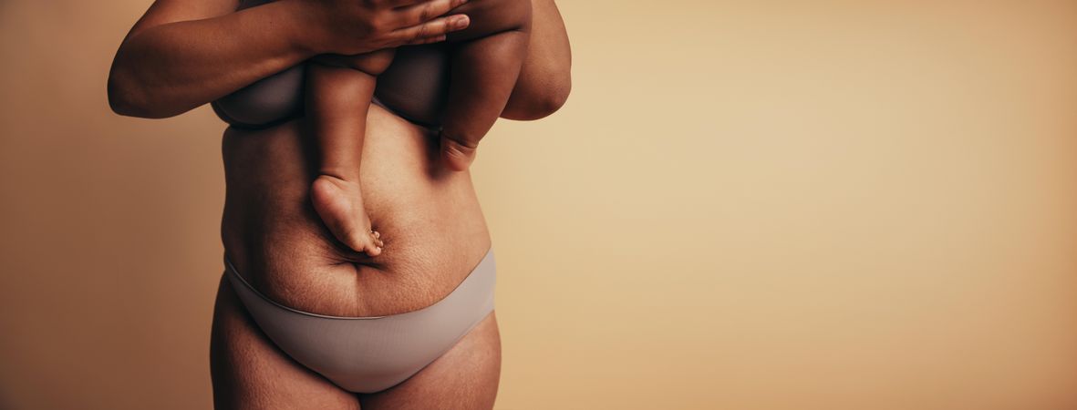 Cropped shot of woman’s postpartum body with stretch marks