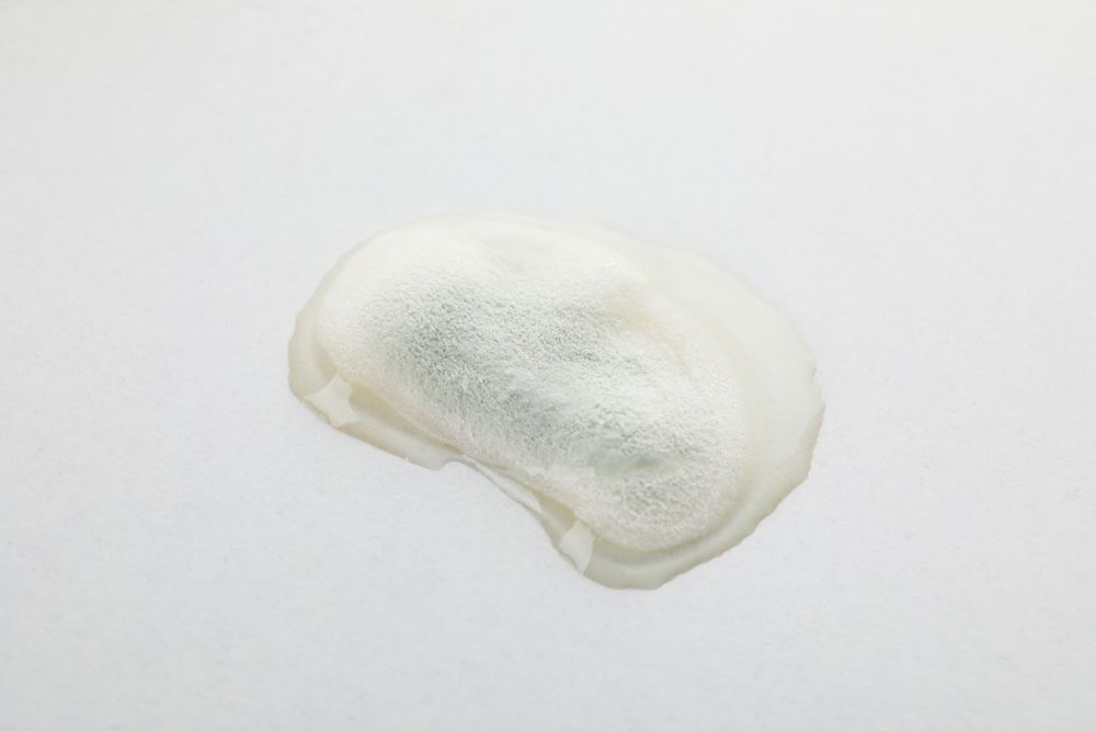 Concept of mold, mold on light background, close up