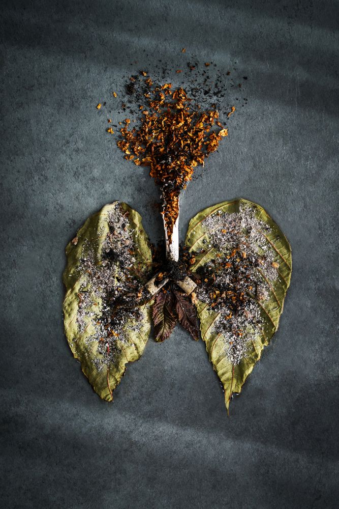 Smoking causes lung cancer and diseases