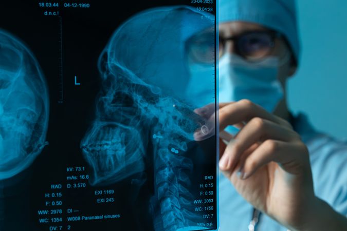 Doctor analyzing skull X-ray with stylus