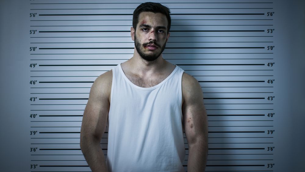 In a Police Station Arrested Beaten Man Poses for Front View Mugshot.