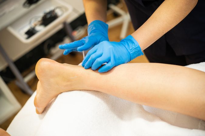 Medical professional in latex gloves doing dry needling on leg